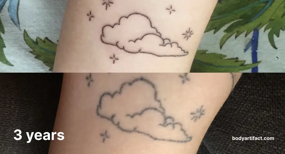I got a fine line tattoo it was so pretty  intricate but a year on it  looks completely different  I totally regret it  The Sun